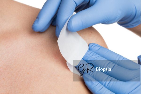 Biopsia – Guichell Biopsia - Guichell