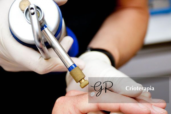 Crioterapia Crioterapia