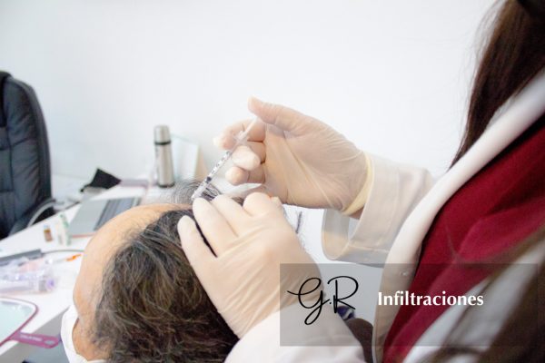 Infiltraciones – Guichell Infiltraciones - Guichell